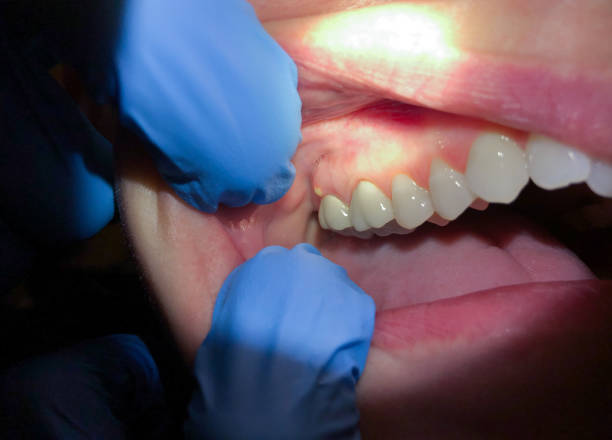 Trusted MS Emergency Dental Service Experts