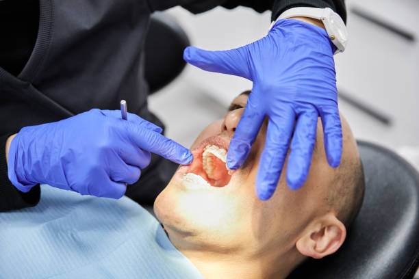 Best Lost Filling or Crown Replacement in West Hattiesburg, MS